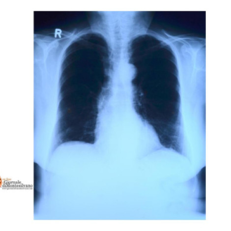 Abruzzo/Sanità, arriva la piattaforma VNA: immagini radiologiche regionali centralizzate e condivise