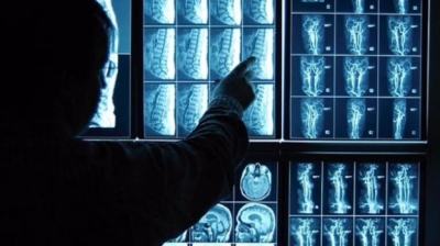Italia maglia nera per le apparecchiature diagnostiche: 58.000 obsolete