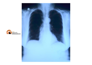 Importante studio sullo Streptococcus Pneumoniae presso l’Ospedale di Pescara