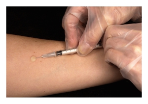 Vaccino AstraZeneca: morto un volontario in Brasile