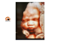 Chieti, feto salvato con trasfusione all'utero. E' una bimba: catturata mentre sorride.