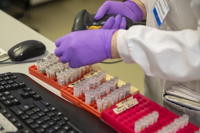 Coronavirus, dati in Abruzzo: 35 nuovi casi. 123 decessi totali.