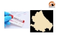 Abruzzo/Covid19, 623 nuovi casi. Medici: test antigienici rapidi nei propri ambulatori.