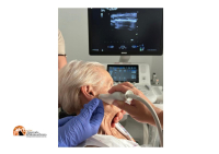 Vasto, trattamenti con il botulino  per cefalee e malattie neurologiche