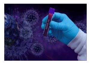 Abruzzo/Covid 19. Sono 423 i nuovi casi e 4 i decessi.